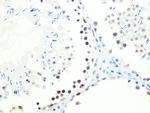 DKC1 Antibody in Immunohistochemistry (Paraffin) (IHC (P))