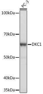 DKC1 Antibody in Western Blot (WB)