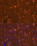 CRMP2 Antibody in Immunohistochemistry (Paraffin) (IHC (P))