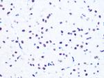 NuMA Antibody in Immunohistochemistry (Paraffin) (IHC (P))