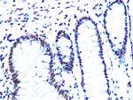 NuMA Antibody in Immunohistochemistry (Paraffin) (IHC (P))