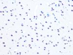 NuMA Antibody in Immunohistochemistry (Paraffin) (IHC (P))