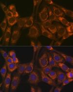 Thioredoxin 2 Antibody in Immunocytochemistry (ICC/IF)