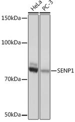 SENP1 Antibody in Western Blot (WB)