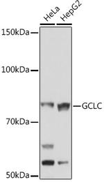 GCLC Antibody in Western Blot (WB)