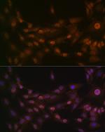 PRMT1 Antibody in Immunocytochemistry (ICC/IF)