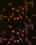 PRMT1 Antibody in Immunocytochemistry (ICC/IF)