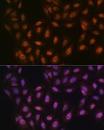 PRMT1 Antibody in Immunocytochemistry (ICC/IF)