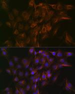 Arp3 Antibody in Immunocytochemistry (ICC/IF)