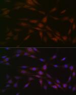 CK2 beta Antibody in Immunocytochemistry (ICC/IF)