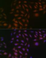 CK2 beta Antibody in Immunocytochemistry (ICC/IF)