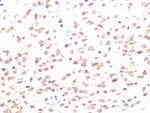 CK2 beta Antibody in Immunohistochemistry (Paraffin) (IHC (P))