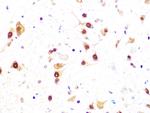 CK2 beta Antibody in Immunohistochemistry (Paraffin) (IHC (P))