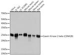 CK2 beta Antibody in Western Blot (WB)