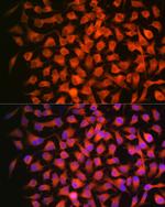 RARB Antibody in Immunocytochemistry (ICC/IF)