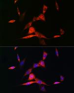 RARB Antibody in Immunocytochemistry (ICC/IF)