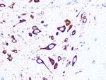 FMRP Antibody in Immunohistochemistry (Paraffin) (IHC (P))