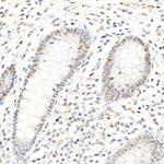 PMS2 Antibody in Immunohistochemistry (Paraffin) (IHC (P))