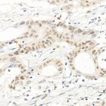 PMS2 Antibody in Immunohistochemistry (Paraffin) (IHC (P))