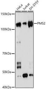 PMS2 Antibody in Western Blot (WB)