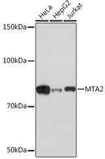 MTA2 Antibody in Western Blot (WB)