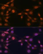 MAD2L2 Antibody in Immunocytochemistry (ICC/IF)