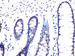 MAD2L2 Antibody in Immunohistochemistry (Paraffin) (IHC (P))