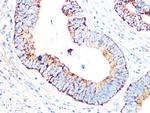 PDHB Antibody in Immunohistochemistry (Paraffin) (IHC (P))