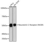 TACR1 Antibody in Western Blot (WB)