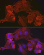 Villin Antibody in Immunocytochemistry (ICC/IF)