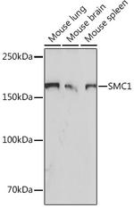 SMC1 Antibody in Western Blot (WB)