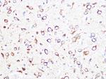 TCP-1 beta Antibody in Immunohistochemistry (Paraffin) (IHC (P))