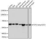 TCP-1 beta Antibody in Western Blot (WB)