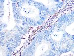 Galectin 1 Antibody in Immunohistochemistry (Paraffin) (IHC (P))