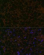 Perilipin 1 Antibody in Immunocytochemistry (ICC/IF)