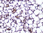 Perilipin 1 Antibody in Immunohistochemistry (Paraffin) (IHC (P))