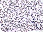 Perilipin 1 Antibody in Immunohistochemistry (Paraffin) (IHC (P))