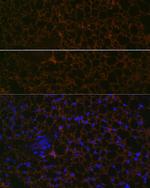 Perilipin 1 Antibody in Immunohistochemistry (Paraffin) (IHC (P))