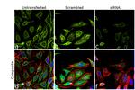 Calnexin Antibody in Immunocytochemistry (ICC/IF)