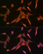 RhoA/RhoB/RhoC Antibody in Immunocytochemistry (ICC/IF)