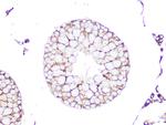 RhoA/RhoB/RhoC Antibody in Immunohistochemistry (Paraffin) (IHC (P))