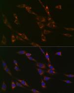 RPS3 Antibody in Immunocytochemistry (ICC/IF)