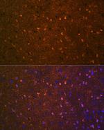 BDNF Antibody in Immunohistochemistry (Paraffin) (IHC (P))