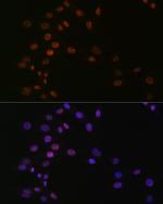 ASH2L Antibody in Immunocytochemistry (ICC/IF)