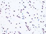 ASH2L Antibody in Immunohistochemistry (Paraffin) (IHC (P))