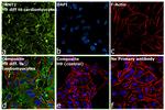 Cardiac Troponin T Antibody