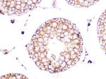 Clathrin Heavy Chain Antibody in Immunohistochemistry (Paraffin) (IHC (P))