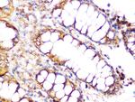 Clathrin Heavy Chain Antibody in Immunohistochemistry (Paraffin) (IHC (P))