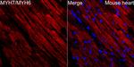 Myosin Heavy Chain Antibody in Immunohistochemistry (Paraffin) (IHC (P))