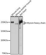 Myosin Heavy Chain Antibody in Western Blot (WB)